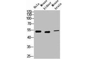 Western blot analysis of 1) Hela, 2) Mouse Kidney, 3) Mouse Brain, diluted at 1:2000. (Cytokeratin 7 抗体)