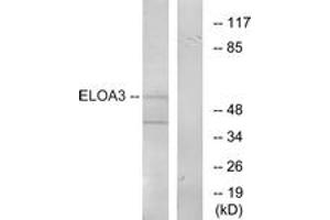 Western blot analysis of extracts from COLO205 cells, using ELOA3 Antibody. (TCEB3C 抗体  (AA 381-430))