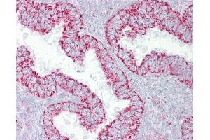 Anti-PDGFB antibody IHC of human uterus. (PDGF-BB Homodimer (N-Term) 抗体)