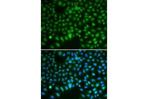 Immunofluorescence (IF) image for anti-Discs, Large (Drosophila) Homolog-Associated Protein 5 (DLGAP5) (AA 547-846) antibody (ABIN3023190) (DLGAP5 抗体  (AA 547-846))