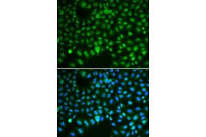 Immunofluorescence (IF) image for anti-Discs, Large (Drosophila) Homolog-Associated Protein 5 (DLGAP5) (AA 547-846) antibody (ABIN3023190) (DLGAP5 抗体  (AA 547-846))