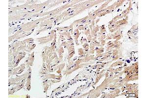 Immunohistochemistry (Paraffin-embedded Sections) (IHC (p)) image for anti-4-Hydroxynonenal (HNE) antibody (ABIN873270)