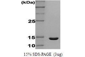 Figure annotation denotes ug of protein loaded and % gel used. (Interferon gamma Protein (IFNG))