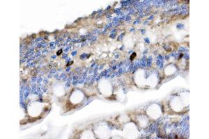 anti-Secretin (SECR) (AA 25-65) antibody