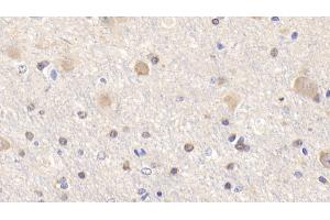 Detection of Bid in Human Cerebrum Tissue using Polyclonal Antibody to BH3 Interacting Domain Death Agonist (Bid) (BID 抗体  (AA 1-195))