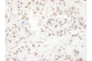 Immunohistochemistry (IHC) image for anti-ELK1, Member of ETS Oncogene Family (ELK1) (AA 200-250) antibody (ABIN7454491)