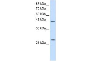 Western Blot showing CBX6 antibody used at a concentration of 1-2 ug/ml to detect its target protein. (CBX6 抗体  (N-Term))