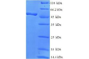 RPH3AL Protein (AA 1-315, full length) (His-SUMO Tag)