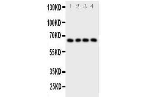 Western Blotting (WB) image for anti-Parathyroid Hormone 1 Receptor (PTH1R) (AA 388-406), (C-Term) antibody (ABIN3043983) (PTH1R 抗体  (C-Term))