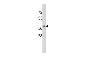 Western blot analysis of SRC Antibody (C-term) (ABIN390705 and ABIN2840989) in Y79 cell line lysates (35 μg/lane). (SPARC 抗体  (C-Term))