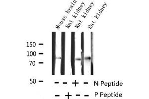 Western blot analysis of Phospho-Tau (Ser214) expression in various lysates (MAPT 抗体  (pSer214))