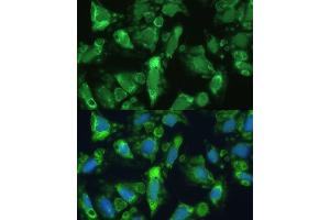 Immunofluorescence analysis of U-2 OS cells using ENO1 antibody (ABIN3021299, ABIN3021300, ABIN3021301, ABIN1512865 and ABIN6214545) at dilution of 1:100. (ENO1 抗体  (AA 1-434))