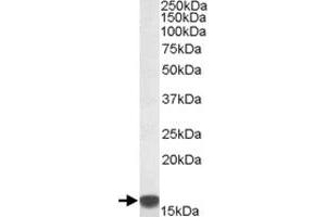 S100A9 polyclonal antibody  (0.