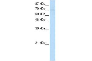 WB Suggested Anti-ZNF282 Antibody Titration:  1. (ZNF282 抗体  (N-Term))