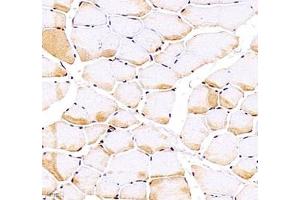 Immunohistochemistry of paraffin embedded rat Skeletal muscle using Troponin I f(ABIN7076031) at dilution of 1:700 (400x lens) (TNNI2 抗体)