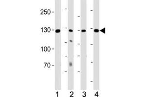 Western blot analysis of lysate from (1) K562 cell line, (2) human lung, (3) mouse kidney and (4) mouse heart tissue using ROR1 antibody at 1:1000. (ROR1 抗体)