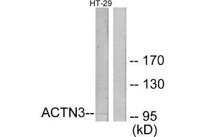 Western Blotting (WB) image for anti-Actinin, alpha 3 (ACTN3) (N-Term) antibody (ABIN1850168) (ACTN3 抗体  (N-Term))