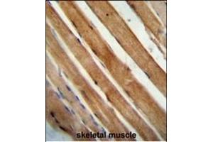 Immunohistochemistry (Paraffin-embedded Sections) (IHC (p)) image for anti-Solute Carrier Family 25 (Mitochondrial Carrier, Aralar), Member 12 (Slc25a12) (AA 1-30), (N-Term) antibody (ABIN654231)