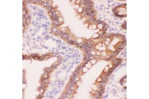Anti-CTNNA1 Picoband antibody,  IHC(P): Rat Intestine Tissue (CTNNA1 抗体  (AA 143-292))