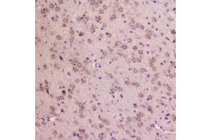 IHC testing of FFPE rat brain tissue with IGFBP2 antibody at 2ug/ml.