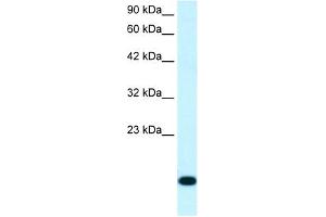 RPS16 antibody (20R-1082) used at 0. (RPS16 抗体  (N-Term))