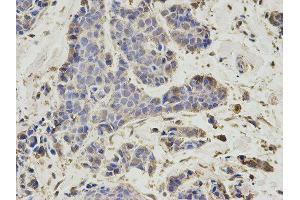 Immunohistochemistry (IHC) image for anti-Proteasome (Prosome, Macropain) 26S Subunit, Non-ATPase, 7 (PSMD7) antibody (ABIN1876544) (PSMD7 抗体)