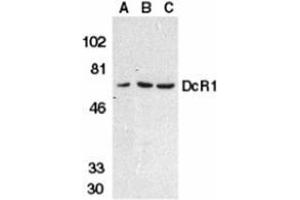 Western blot analysis of DcR1 in HeLa cell (A), mouse (B) and rat (C) liver tissue lysates with AP30279PU-N DcR1 antibody at 1 μg/ml. (DcR1 抗体)