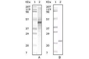 Western Blot showing Apoa5 antibody used against human serum (A) and Apoa5 recombinant protein (B). (APOA5 抗体)