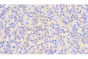Detection of ATG16L1 in Human Pancreas Tissue using Polyclonal Antibody to Autophagy Related Protein 16 Like Protein 1 (ATG16L1) (ATG16L1 抗体  (AA 342-607))