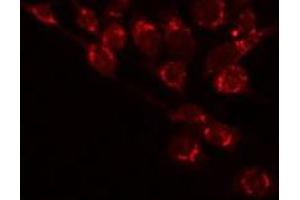 ABIN6277297 staining 293 by IF/ICC. (Betacellulin 抗体  (N-Term))
