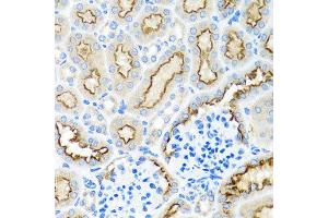 Immunohistochemistry of paraffin-embedded mouse kidney using RPS2 antibody at dilution of 1:100 (x40 lens). (RPS2 抗体)