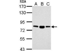 ACSL4 抗体  (C-Term)