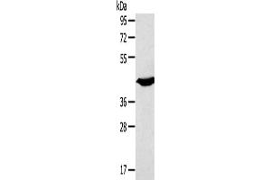Gel: 8 % SDS-PAGE, Lysate: 40 μg, Lane: Mouse heart tissue, Primary antibody: ABIN7191189(KCNK3 Antibody) at dilution 1/200, Secondary antibody: Goat anti rabbit IgG at 1/8000 dilution, Exposure time: 10 seconds (KCNK3 抗体)