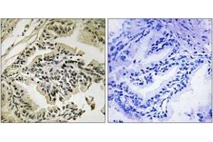 Immunohistochemistry (IHC) image for anti-Eukaryotic Translation Initiation Factor 2-alpha Kinase 3 (EIF2AK3) (AA 947-996), (pThr981) antibody (ABIN1532072)
