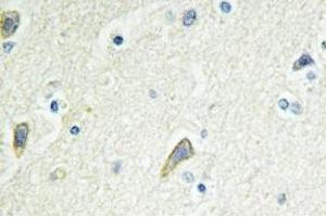 Immunohistochemistry analysis of EphB4 Antibody in paraffin-embedded human brain tissue. (EPH Receptor B4 抗体)