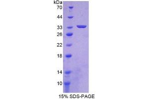 SDS-PAGE of Protein Standard from the Kit (Highly purified E. (HIF1A CLIA Kit)