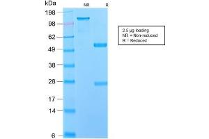 SDS-PAGE Analysis Purified NGFR Rabbit Recombinant Monoclonal Antibody (NGFR/2550R). (Recombinant NGFR 抗体  (AA 281-421))
