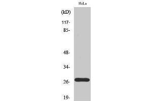 Western Blotting (WB) image for anti-P27 (pThr187) antibody (ABIN3182182) (P27 (pThr187) 抗体)