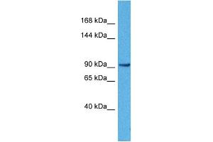 Host:  Rabbit  Target Name:  ACTN3  Sample Tissue:  Human 786-0 Whole Cell  Antibody Dilution:  1ug/ml
