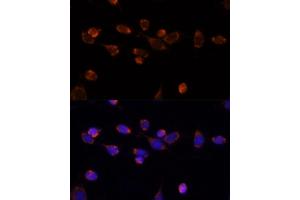 Immunofluorescence analysis of NIH/3T3 cells using PDH antibody (7432) at dilution of 1:100. (PDHA1 抗体)