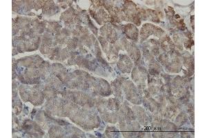 Immunoperoxidase of monoclonal antibody to RIPK2 on formalin-fixed paraffin-embedded human pancreas. (RIPK2 抗体  (AA 431-540))