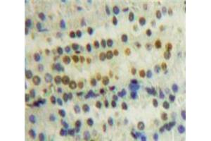 Used in DAB staining on fromalin fixed paraffin-embedded Kidney tissue (PPIE 抗体  (AA 12-286))