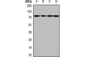 Western blot analysis of HPA2 expression in Hela (A), SKOV3 (B), mouse brain (C), rat brain (D) whole cell lysates. (Heparanase 2 抗体)