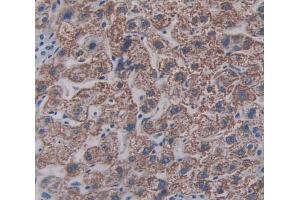 IHC-P analysis of Human Tissue, with DAB staining. (SIGLEC8 抗体  (AA 70-336))