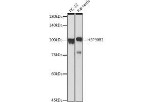 Western Blotting (WB) image for anti-Heat Shock Protein 90kDa beta (Grp94), Member 1 (HSP90B1) (AA 550-650) antibody (ABIN6142031)