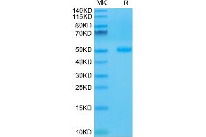 Human CTLA-4 on Tris-Bis PAGE under reduced condition. (CTLA4 Protein (AA 36-161) (Fc Tag))