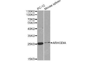 Western blot analysis of extracts of various cell lines, using ARHGDIA antibody. (ARHGDIA 抗体  (AA 1-204))
