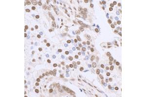 Immunohistochemistry (IHC) image for anti-Sp1 Transcription Factor (SP1) (C-Term) antibody (ABIN7458075) (SP1 抗体  (C-Term))
