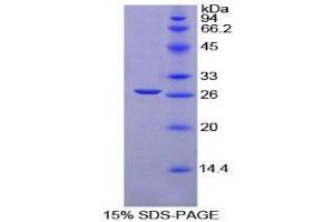 SDS-PAGE (SDS) image for Transforming Growth Factor, beta-Induced, 68kDa (TGFBI) (AA 423-632) protein (His tag) (ABIN2127062)