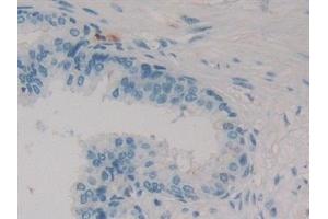 Immunohistochemistry (IHC) image for anti-Calbindin 2 (CALB2) (AA 28-248) antibody (ABIN7432391)